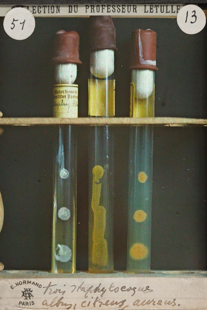 Trois staphylocoques albus, citrus, aureus, collection photographique du Professeur Maurice Letulle (Archives AP-HP, 622W/985).